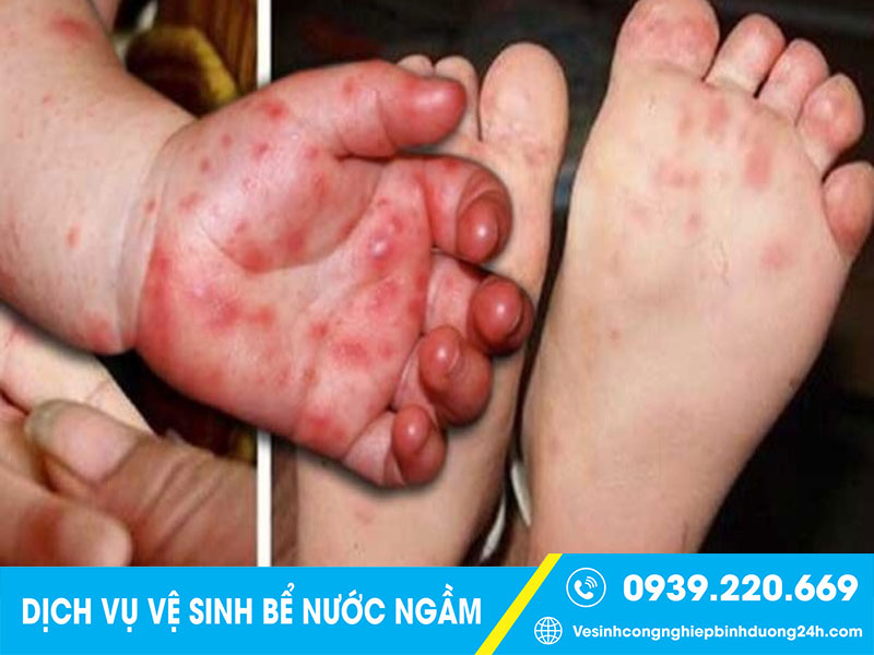 Nguồn nước không đảm bảo do bể chứa nước bẩn gây nhiều vấn đề cho sức khỏe