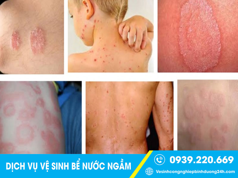 Nguồn nước từ bể nước ngầm bẩn gây nhiều vấn đề cho sức khỏe người sử dụng